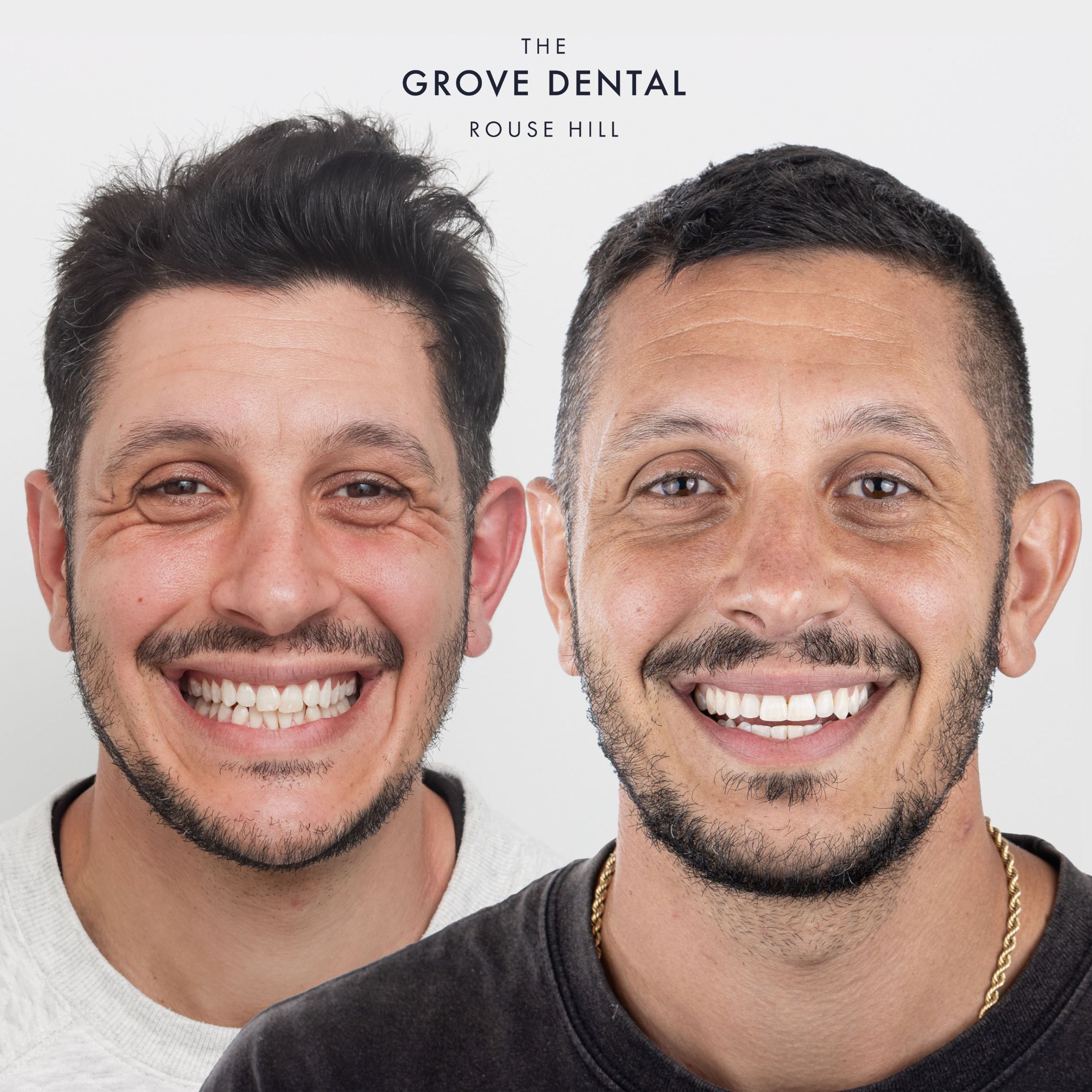 Chris — Clear Aligners
